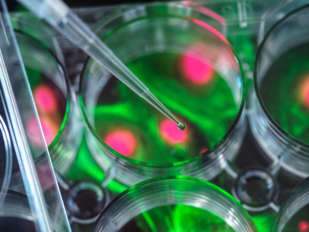 In Vitro Diagnostics LFH Regulatory